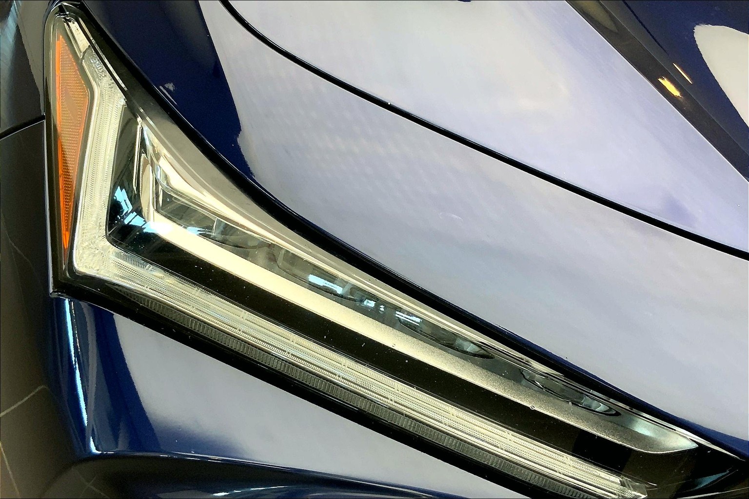 TLX Technology Package