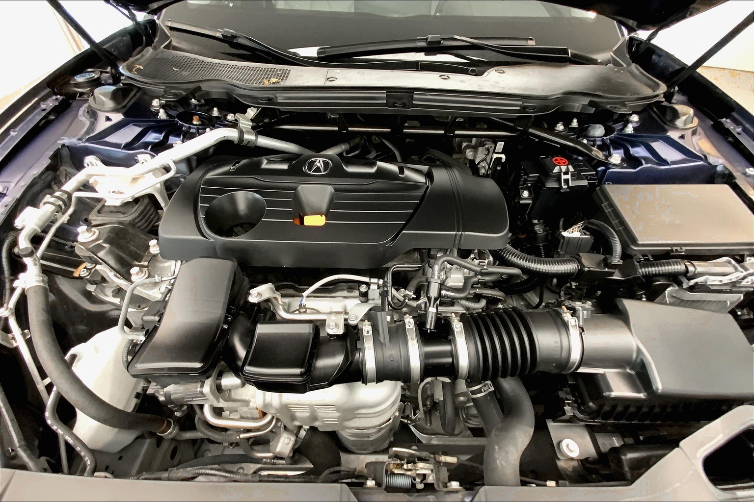 TLX Technology Package