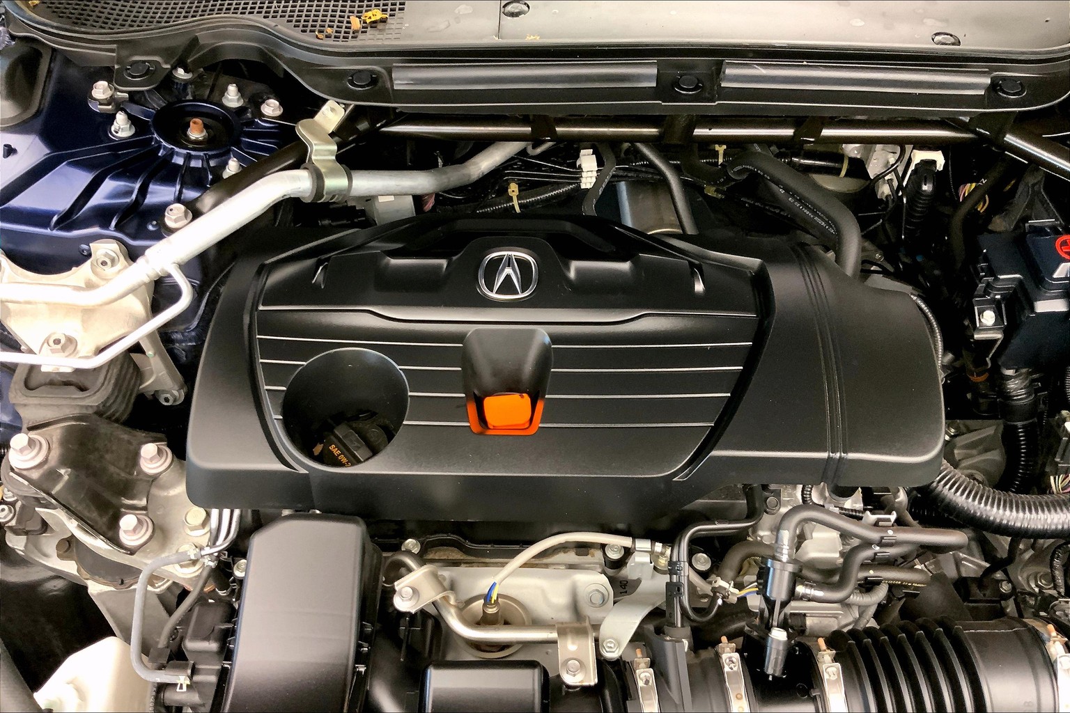 TLX Technology Package