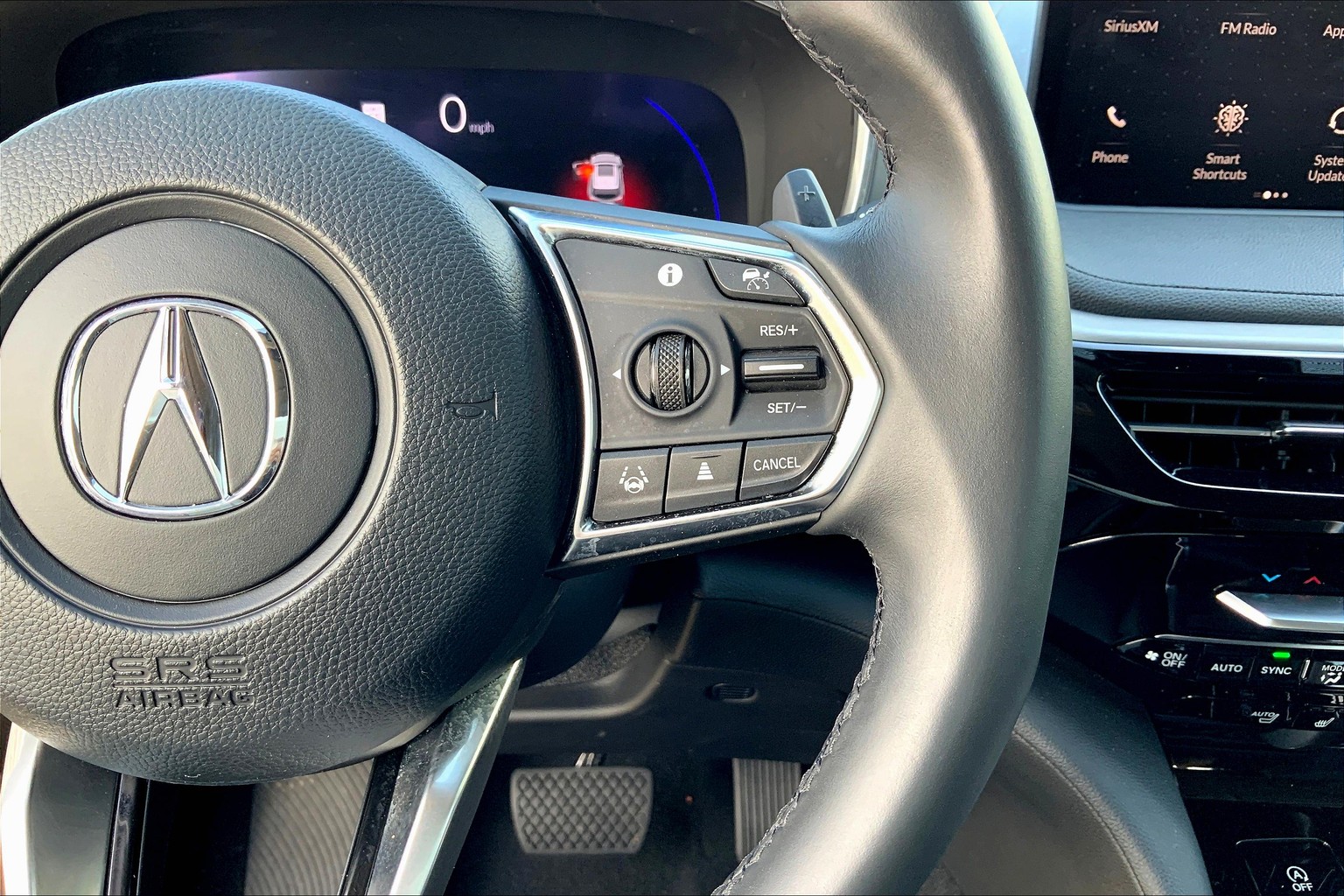 MDX